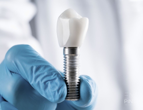 Cirugía Guiada en Implantes: Innovación Dental en Barcelona y Manresa