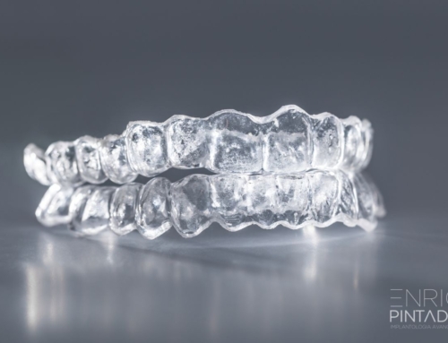 Corrección de la mordida cruzada con ortodoncia invisible