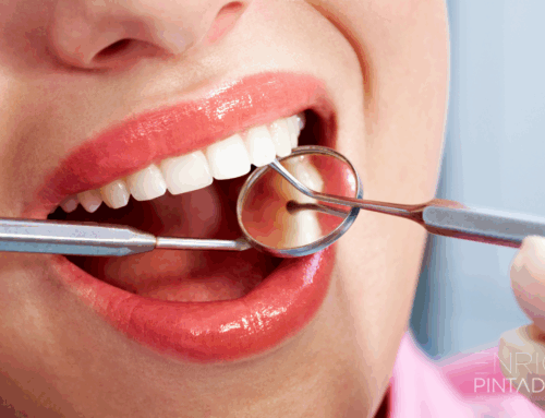 Fracturas dentales: causas, tipos y tratamientos