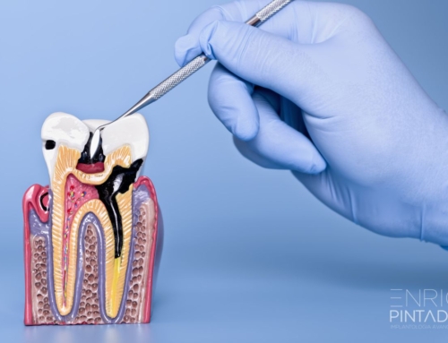 Periodoncia y Carillas Dentales: mantén tus encías sanas y evita gastos adicionales