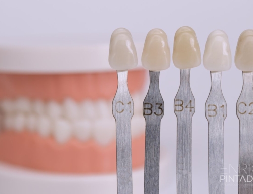 La evolución de las carillas dentales con los años: qué esperar