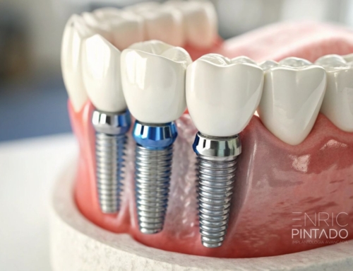 Cómo cuidar implantes dentales para que duren y evitar complicaciones