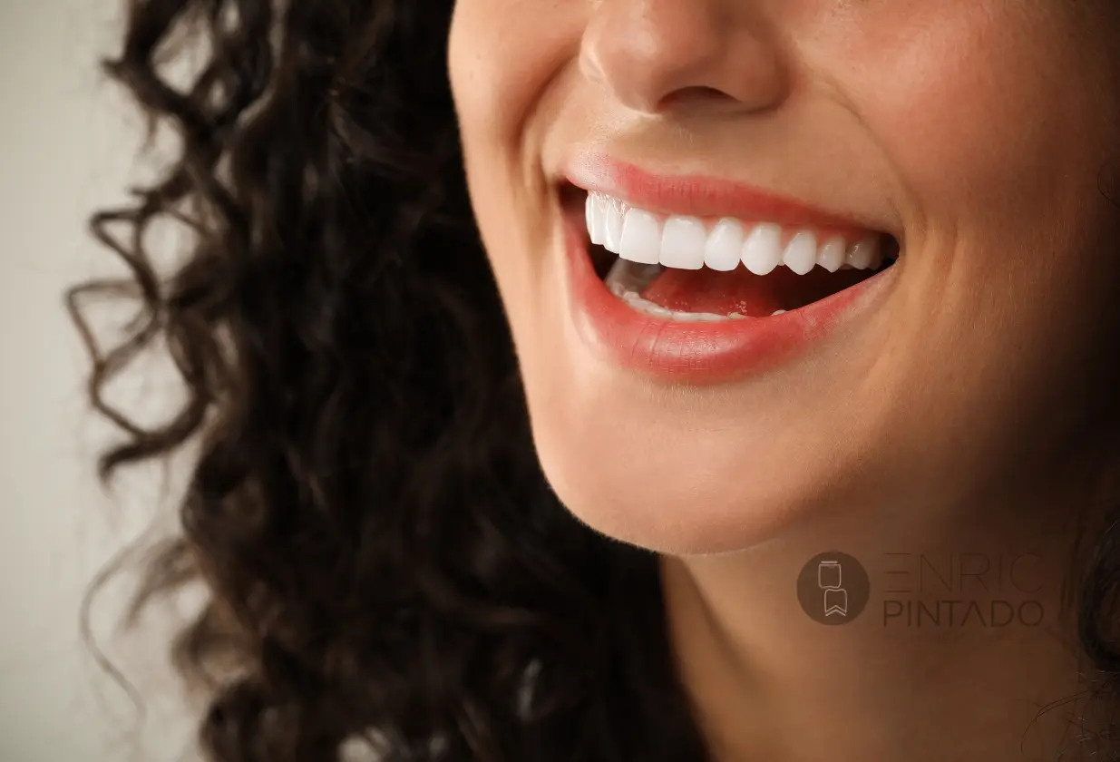 Carillas dentales en Clínica Dental Enric Pintado