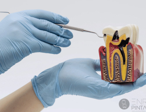 Endodoncia en Barcelona y Manresa: qué es, cuándo se necesita y cómo puede salvar tu diente