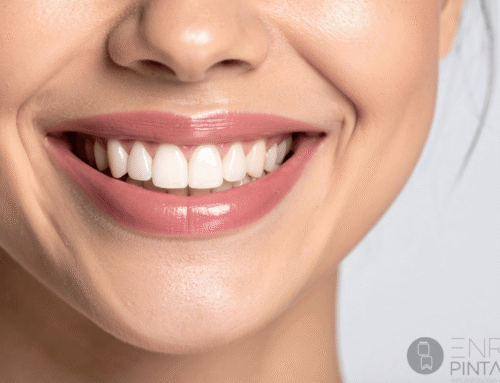 Sonrisa gingival: causas y tratamientos para lograr una sonrisa armónica