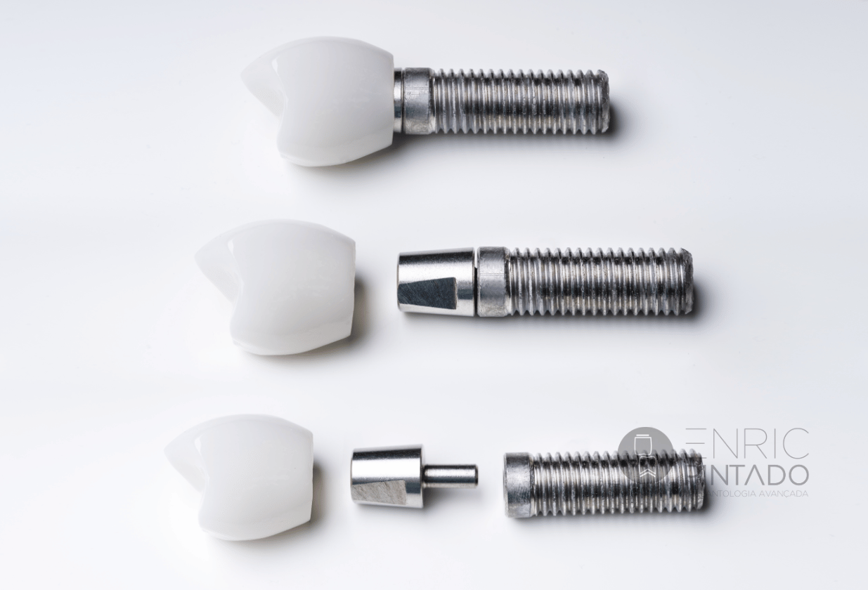 Implantes dentales en casos complejos