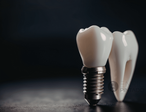 Implantes cigomáticos: la solución para pacientes con poco hueso maxilar