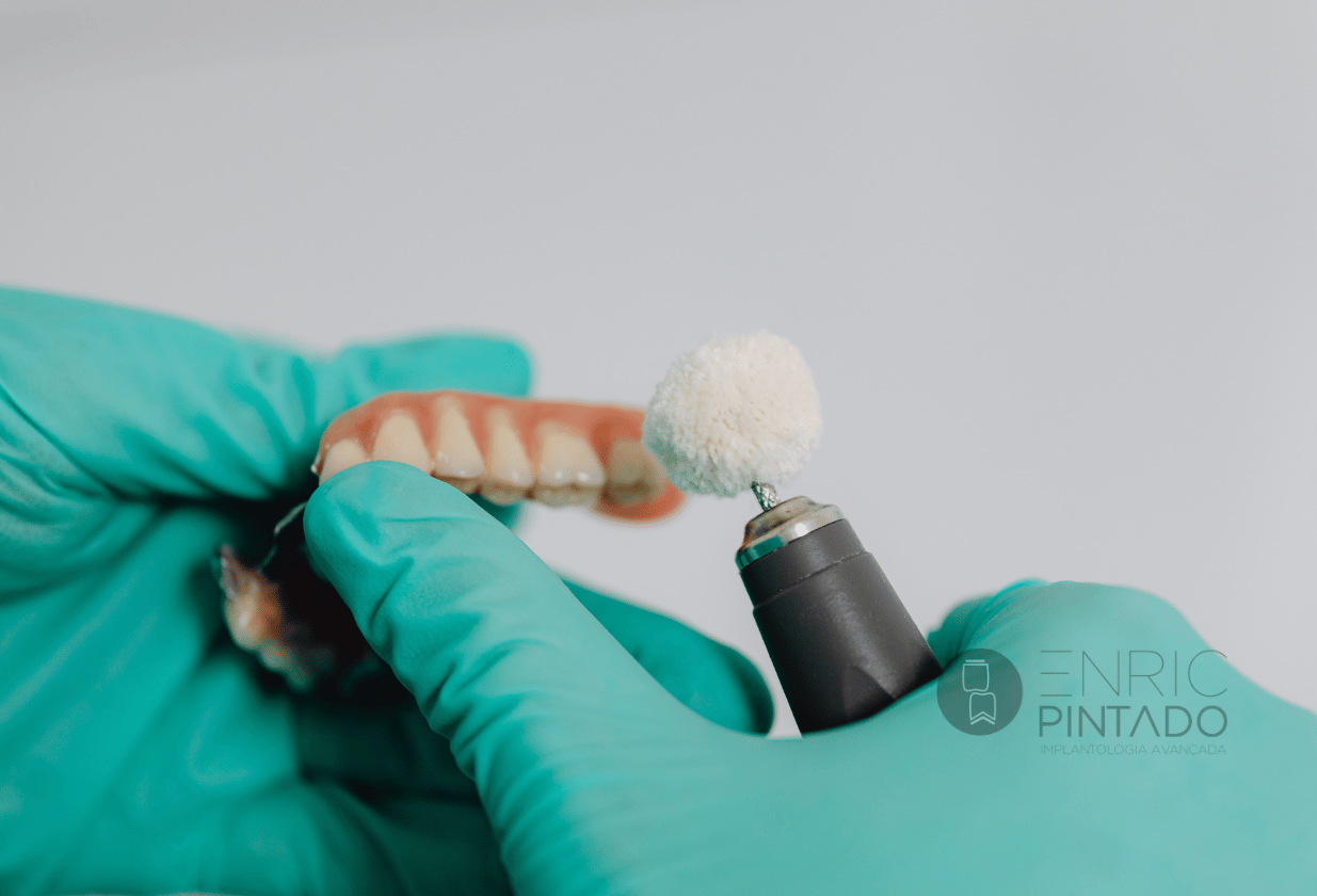 Prótesis provisional sobre implantes